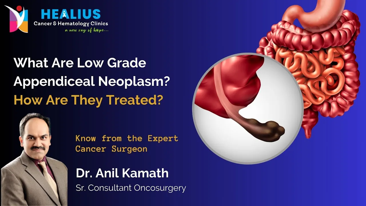 Low Grade Appendiceal Neoplasm and its Treatment