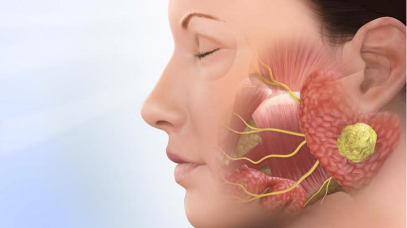 Expert consultation for salivary gland cancer at Healius Clinic in Bangalore.