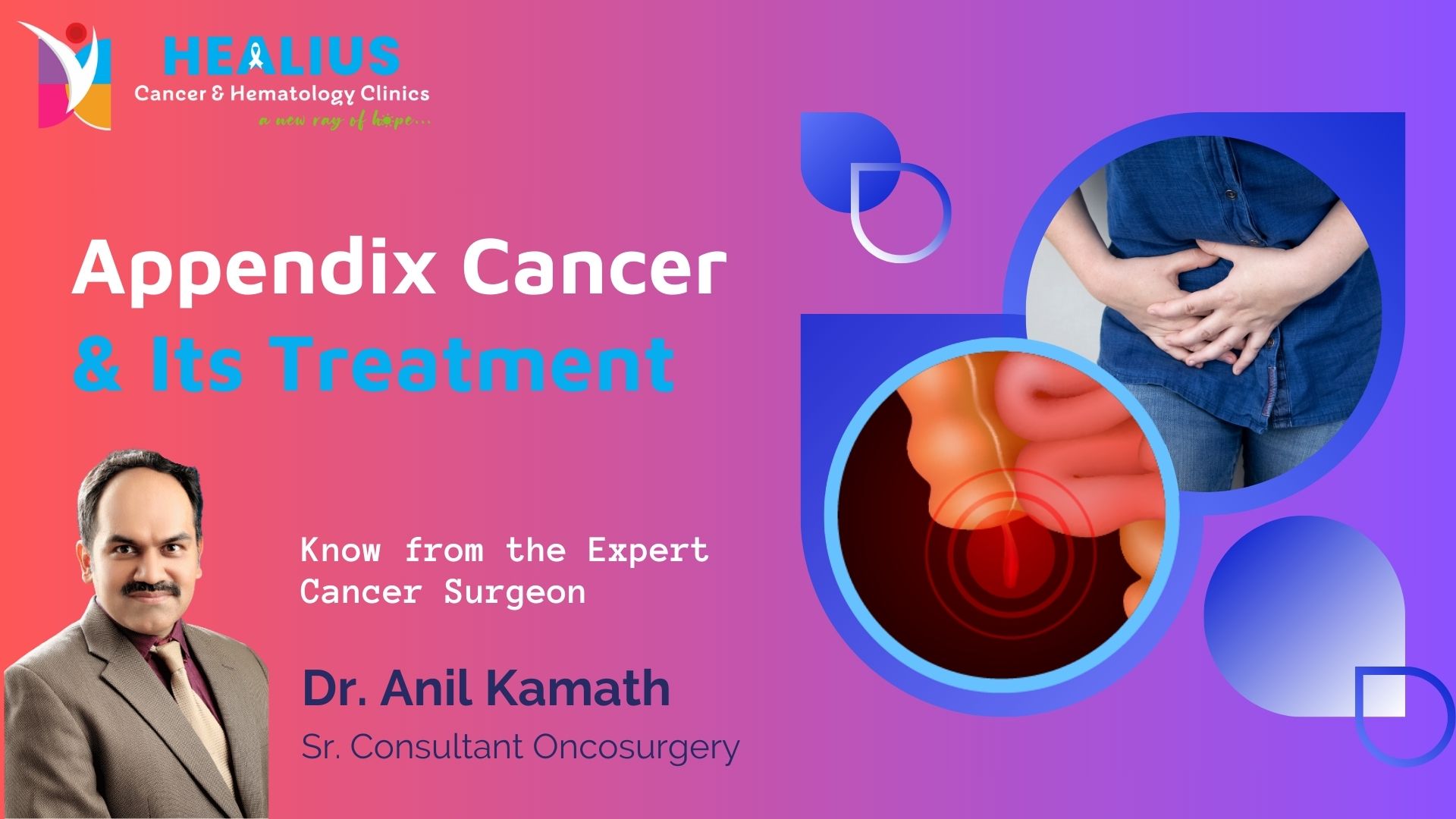 Appendix Cancer & Its Causes