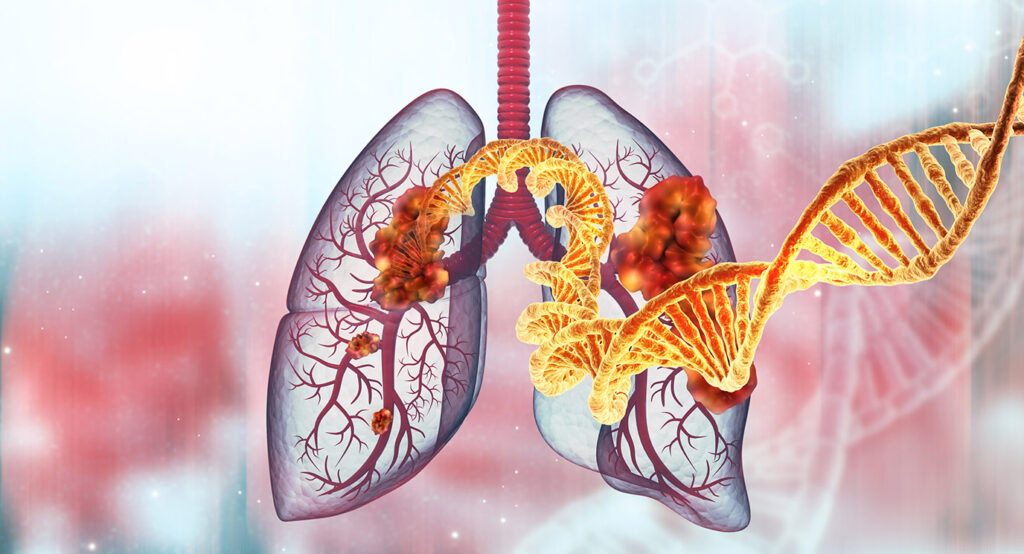 Advanced targeted therapy for lung cancer in India and molecular profiling at Healius Cancer Clinic.