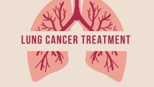 Lung Cancer Treatment in Bangalore | Dr. Mangesh Kamath – Healius Clinics