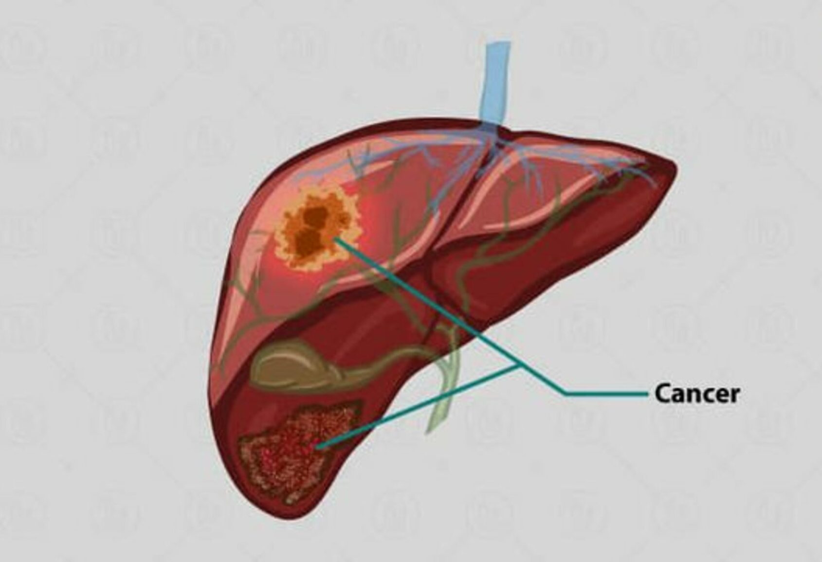 Healius Cancer & Hematology Clinic