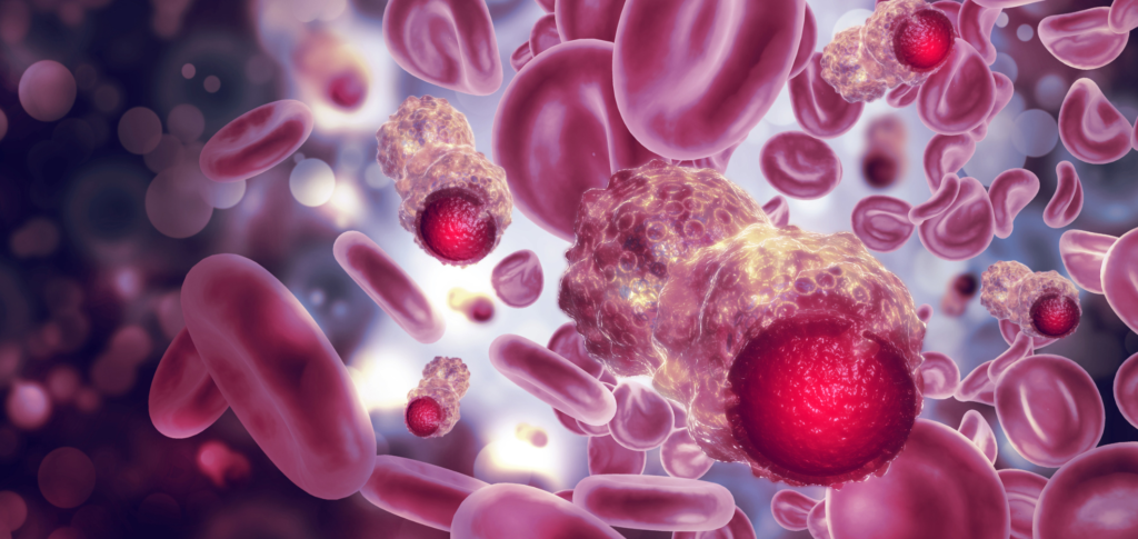 Blood Cancer