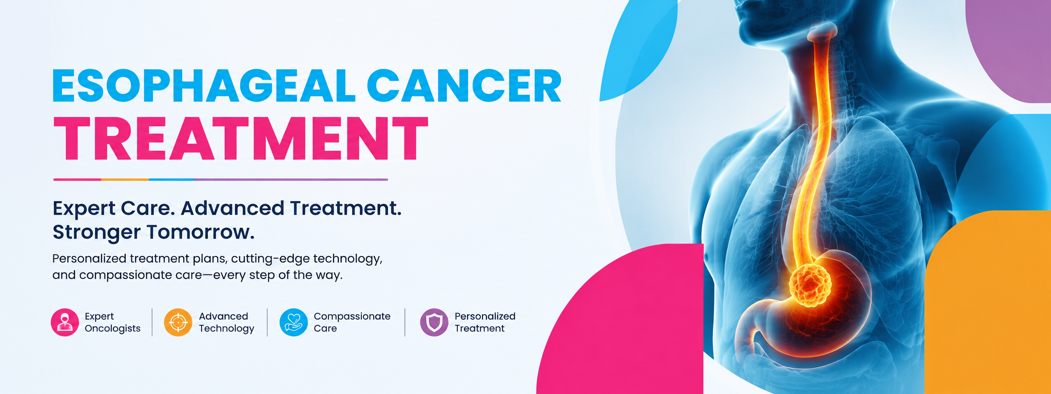 esophageal cancer treatment