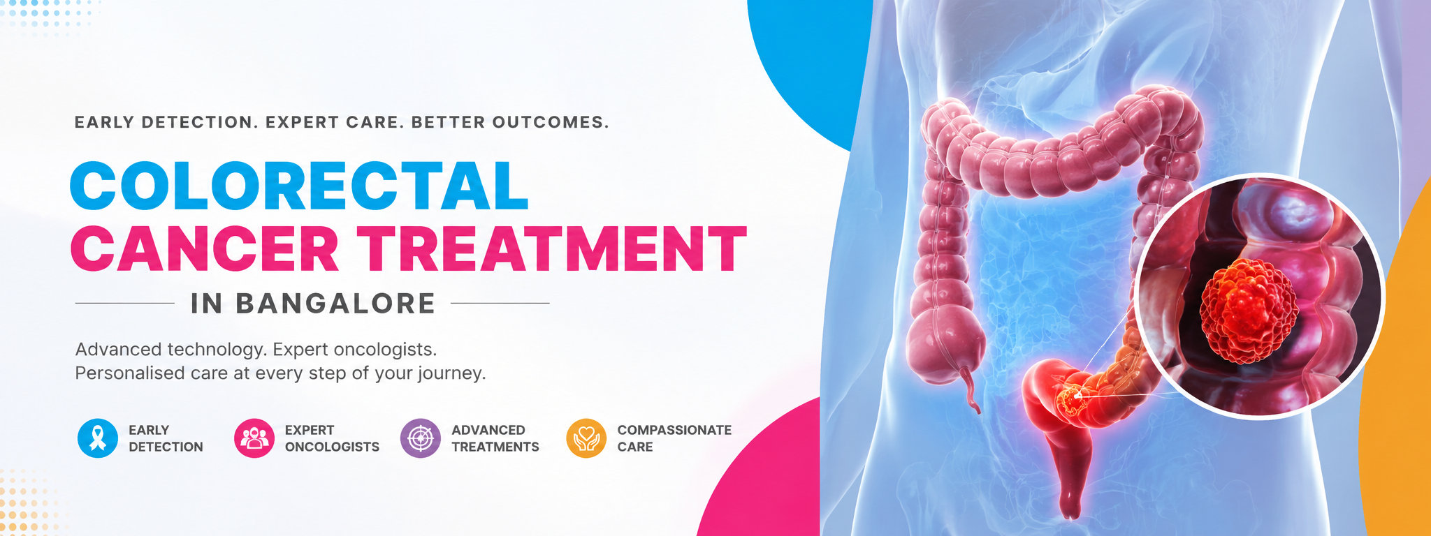 colorectal cancer