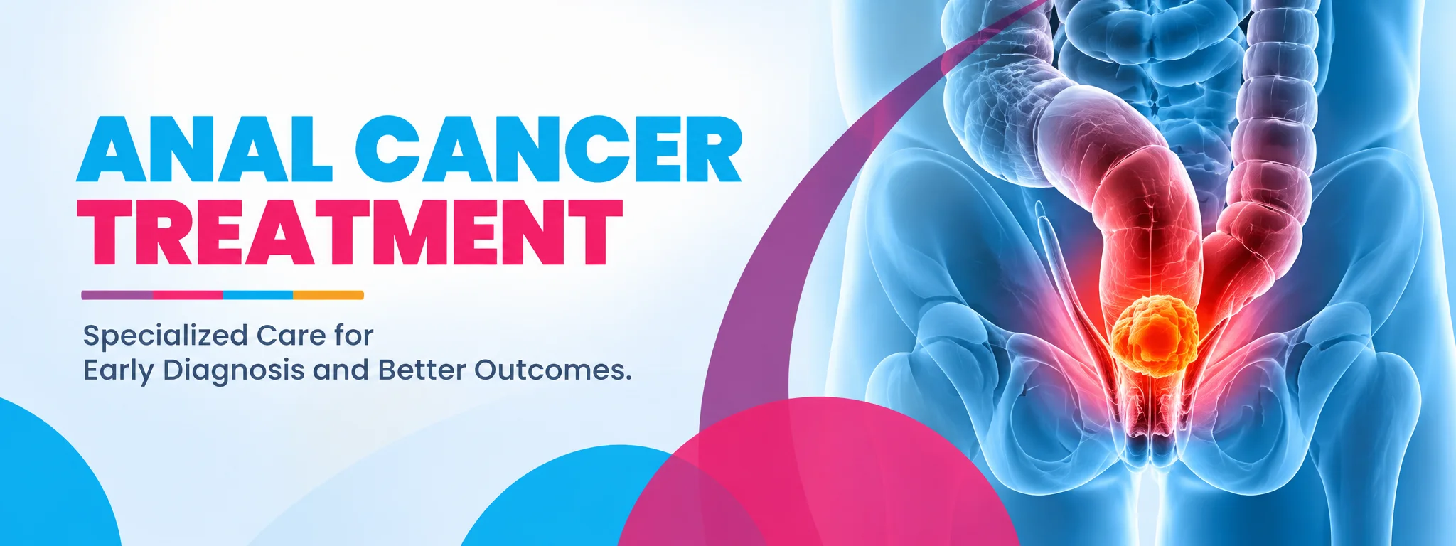 anal cancer treatment in bangalore