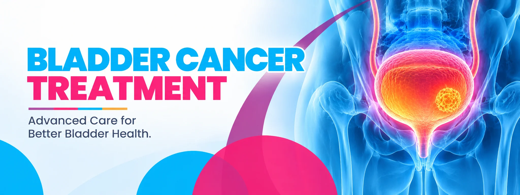bladder cancer treatment
