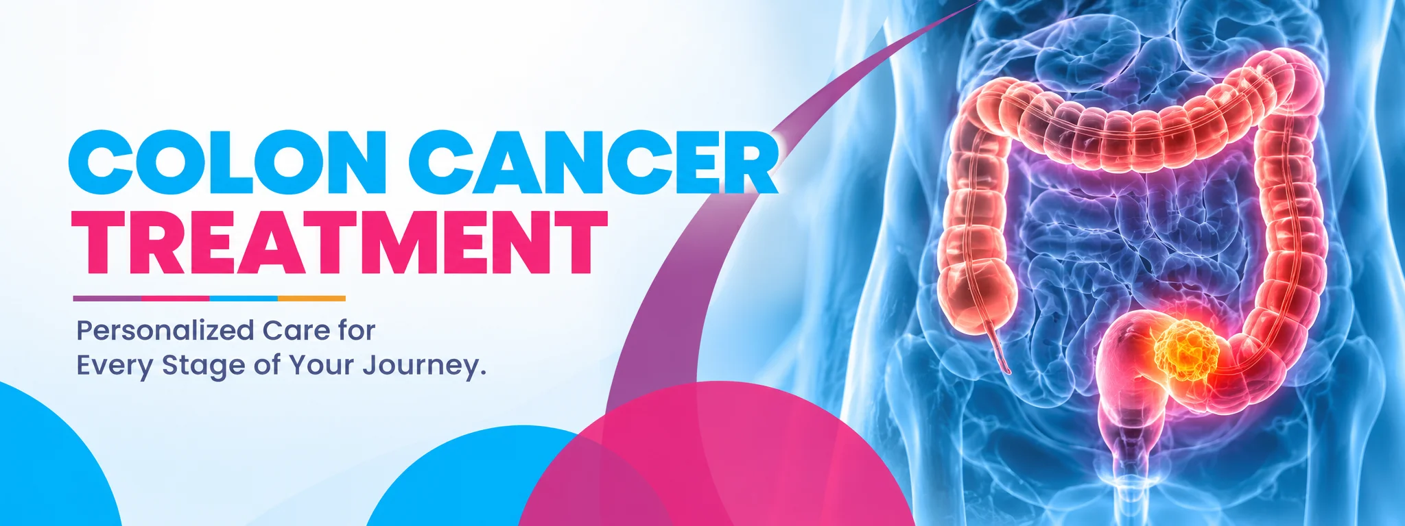 colon cancer treatment in bangalore