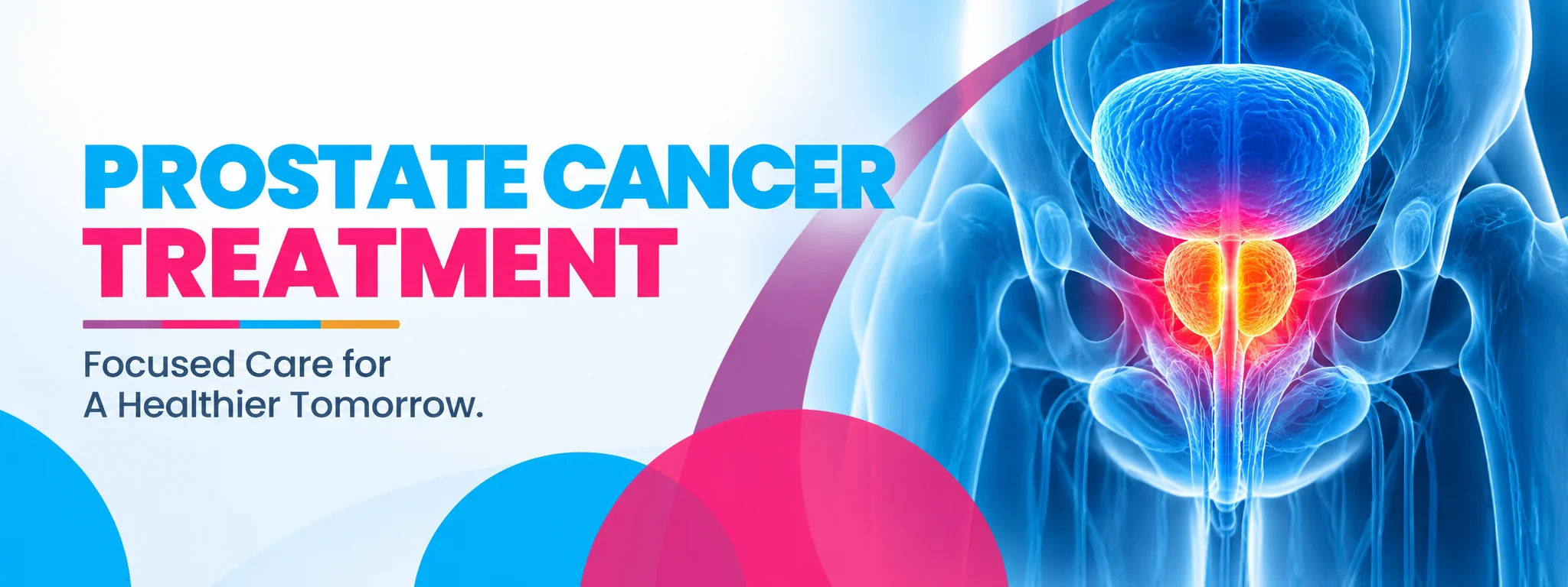 prostate cancer treatment in bangalore