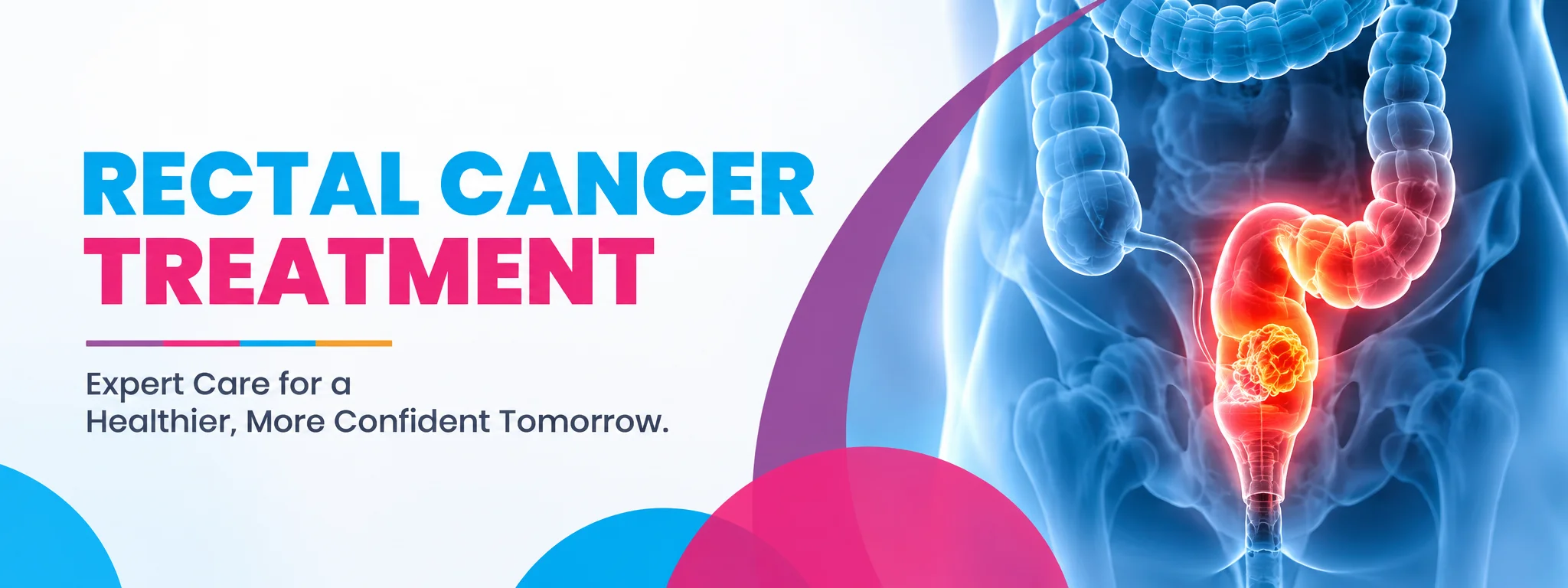 rectal cancer treatment in bangalore