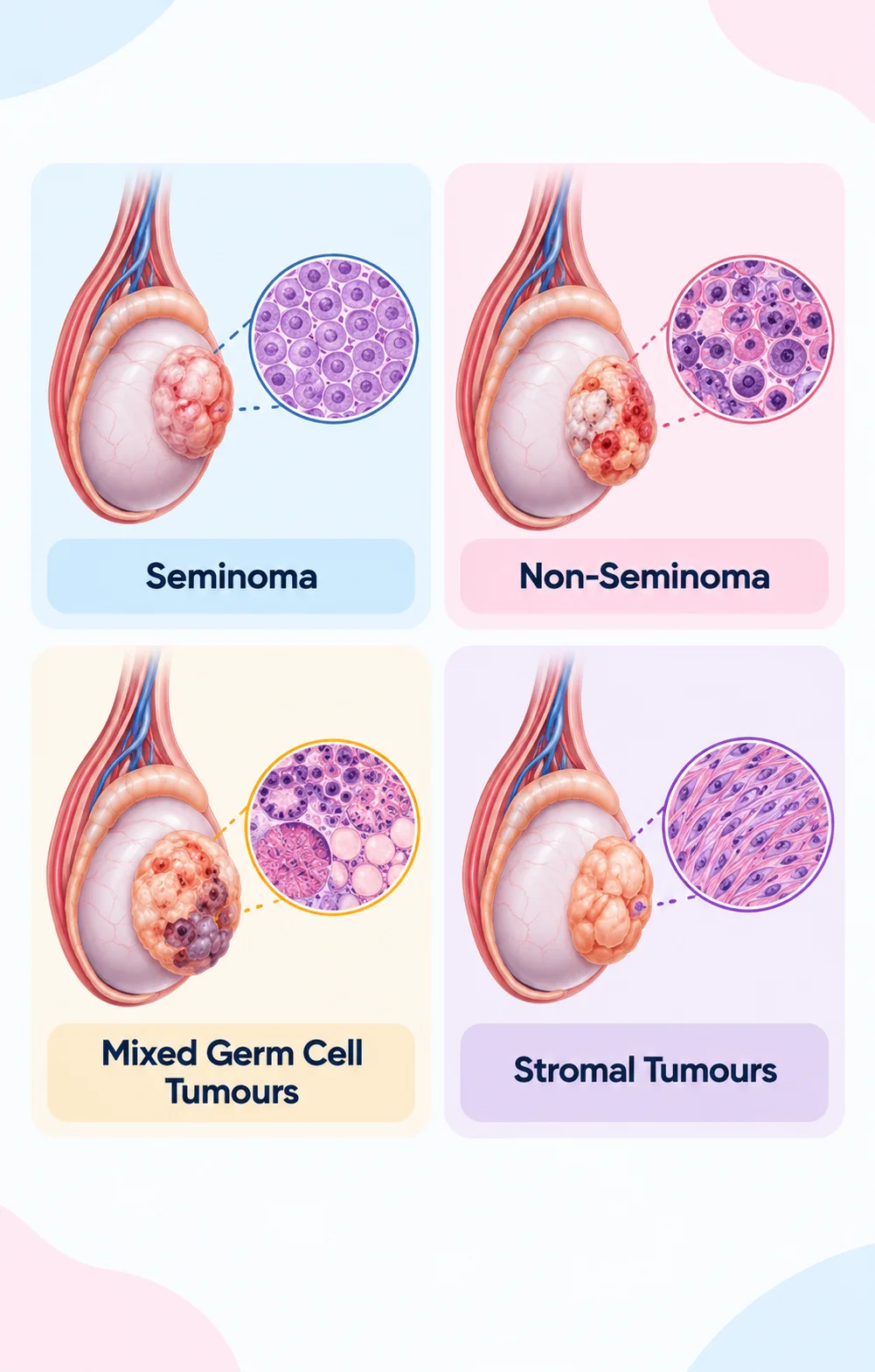 testicular cancer treatment in bangalore