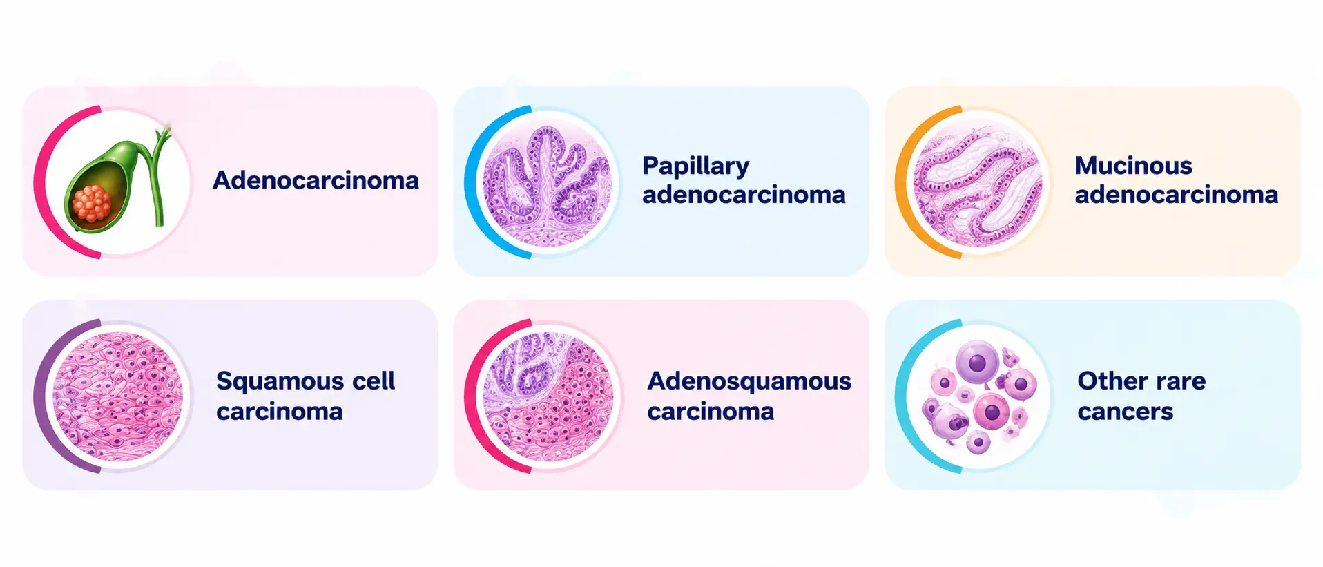 gallbladder cancer