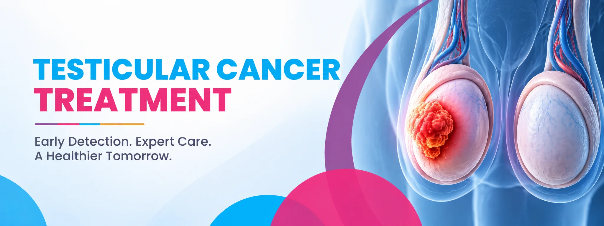 testicular cancer treatment